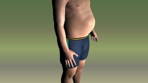 Man Belly Thick Obesity Man Tummy
